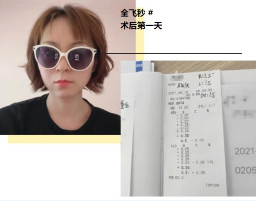 鄭州尖峰眼科全飛秒 20年近視 5分鐘清晰