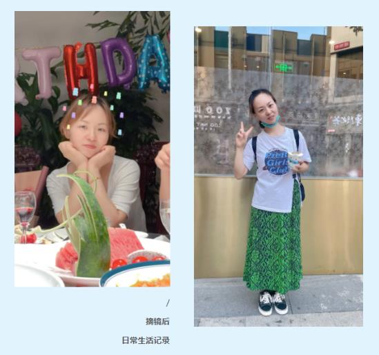 鄭州尖峰眼科全飛秒 20年近視 5分鐘清晰