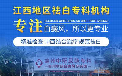 贛州中研皮膚病醫(yī)院治療白癜風(fēng)技術(shù)好 胡亂用藥危害大!