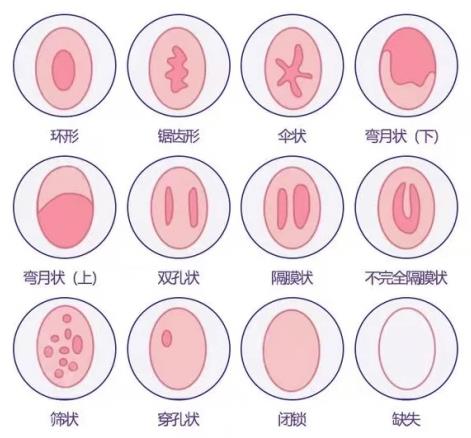 重慶最好的陰道緊縮醫(yī)院是哪家?