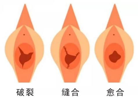 重慶最好的陰道緊縮醫(yī)院是哪家?