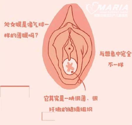 成都哪里醫(yī)院做處女膜修復(fù)正規(guī)?