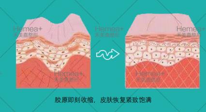 禾美嘉口碑怎么樣?為廣大求美者訂制更好的技術(shù)