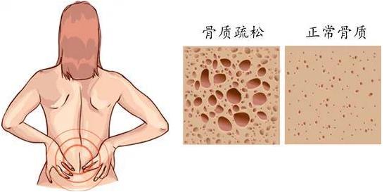 重慶哪個(gè)骨科醫(yī)院好-重慶看關(guān)節(jié)炎哪里好?重慶紅樓醫(yī)院