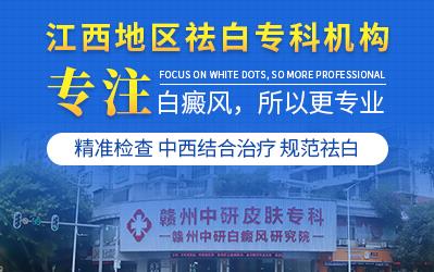 贛州中研皮膚病醫(yī)院治療的效果怎樣?檢查白癜風要做什么項目?