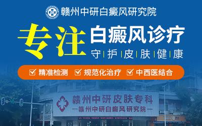 贛州中研白癜風(fēng)研究院收費(fèi)貴嗎?怎樣辨別白斑是不是白癜風(fēng)? 400-250-2.jpg