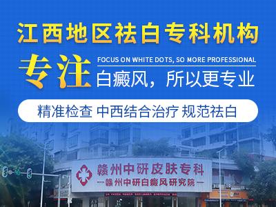 贛州中研白癜風(fēng)研究院口碑好 白癜風(fēng)患者真的不用補維生素C嗎? 400-300-1.jpg