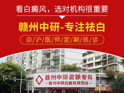贛州中研白癜風(fēng)醫(yī)院趙玉華醫(yī)生上班時(shí)間 白癜風(fēng)具體檢查有哪些? 400-300-5.jpg