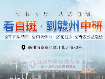 贛州中研白癜風醫(yī)院趙玉華主治醫(yī)師詳解:不得而知的白癜風危害!