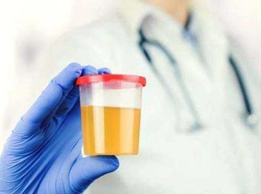 尿酸550不吃藥能降回正常值嗎?年輕人尿酸長(zhǎng)期500左右嚴(yán)重嗎