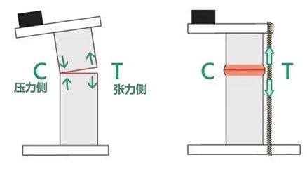 聯(lián)合麗格第一醫(yī)院何照華教授:顴骨內(nèi)推后面部皮膚一定會下垂嗎? 69b954b3ly1gqx0iphr2ej20c606p75g.jpg