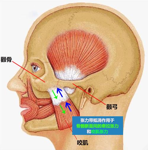聯(lián)合麗格何照華教授:顴骨顴弓術(shù)后只能用鈦板鈦釘固定嗎? 1H33R331-6.png