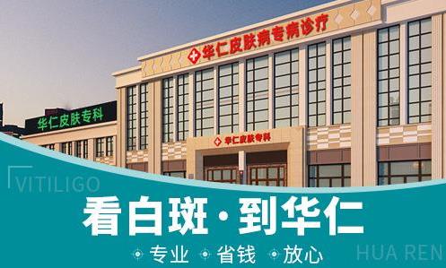寧波華仁白癜風(fēng)醫(yī)院好嗎?青少年白癜風(fēng)應(yīng)該怎么治?