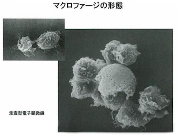 神奇的物質(zhì)LPS—被譽(yù)為21世紀(jì)醫(yī)學(xué)界最偉大的發(fā)現(xiàn)