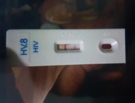 hiv試紙藥店能買到嗎?hiv試紙過期了測出的結(jié)果還準(zhǔn)不準(zhǔn)