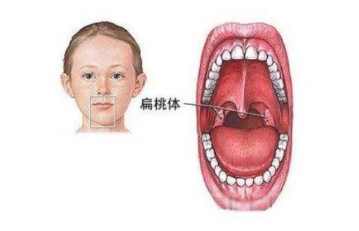 咳嗽噴出一塊石頭 石頭原來(lái)從這里來(lái)