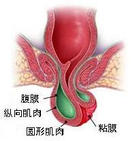 瀘州東大肛腸醫(yī)院收費貴嗎 誠信醫(yī)療收費正規(guī)