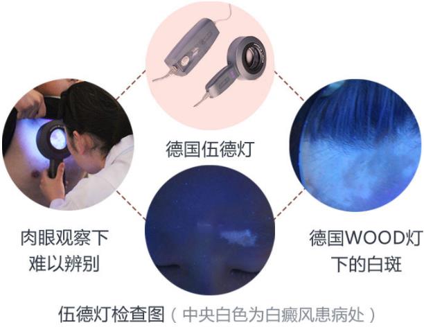 南通白癲風(fēng)醫(yī)院【名醫(yī)會(huì)診公告】上海名醫(yī)秦立模會(huì)診南通復(fù)大