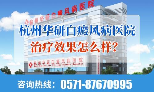 杭州華研白癜風(fēng)病醫(yī)院治療效果怎么樣?