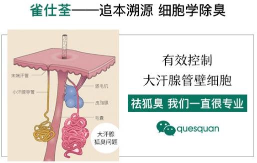治狐臭的藥哪個(gè)最好 挑選是需要必備條件的