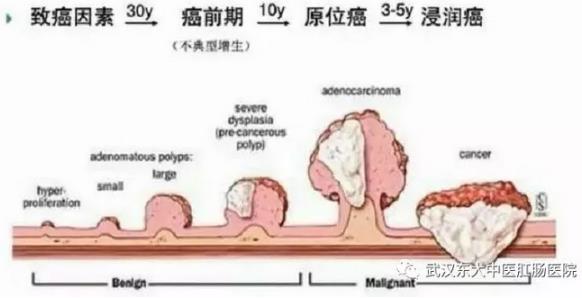 武漢東大肛腸醫(yī)院:記得重視腸道檢查