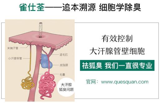 治狐臭最好的藥是哪個 讓您更專業(yè)的得到清香