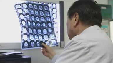 廣州復(fù)大腫瘤醫(yī)院評價(jià):一針消融肺癌