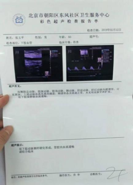 劉繼前技術(shù)怎么樣 動(dòng)脈硬化患者在國(guó)康醫(yī)院完全康復(fù)