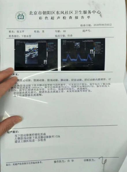 劉繼前技術(shù)怎么樣 動(dòng)脈硬化患者在國(guó)康醫(yī)院完全康復(fù)