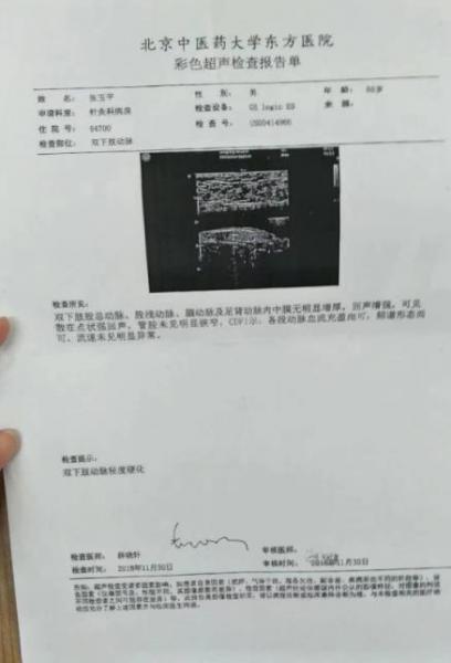 劉繼前技術(shù)怎么樣 動(dòng)脈硬化患者在國(guó)康醫(yī)院完全康復(fù)