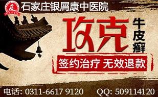 石家莊銀屑康皮膚病中醫(yī)院 頭皮牛皮癬癥狀會消失嗎