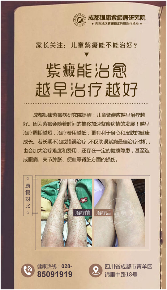 過敏性紫癜能治愈嗎?成都紫癜醫(yī)院排名最佳