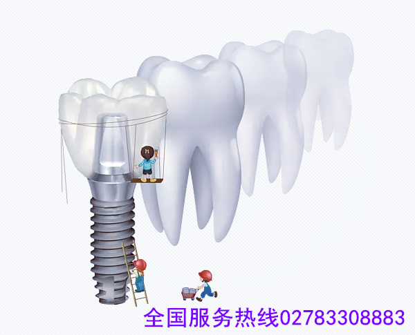 武漢硚口區(qū)種植牙醫(yī)院哪家好? 帶電話種植牙3.png