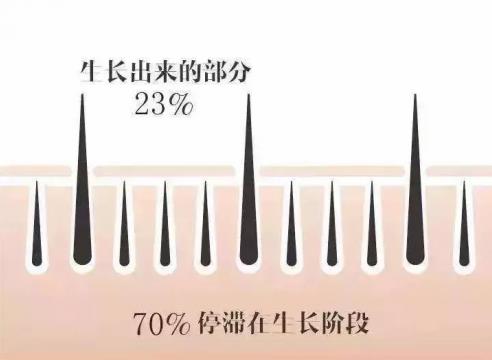 不嫁接、不種植,印度凱普絲careprost睫毛增長(zhǎng)液,愛(ài)美女性必備!