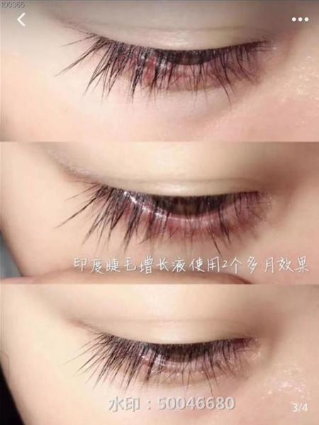 不嫁接、不種植,印度凱普絲careprost睫毛增長(zhǎng)液,愛(ài)美女性必備!