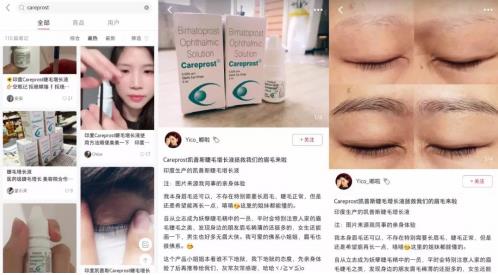 不嫁接、不種植,印度凱普絲careprost睫毛增長(zhǎng)液,愛(ài)美女性必備!