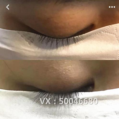 不嫁接、不種植,印度凱普絲careprost睫毛增長(zhǎng)液,愛(ài)美女性必備!