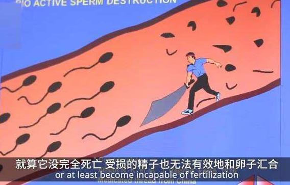 世界首款男性避孕針通過(guò)臨床實(shí)驗(yàn):一針管13年,成功率97.3%!