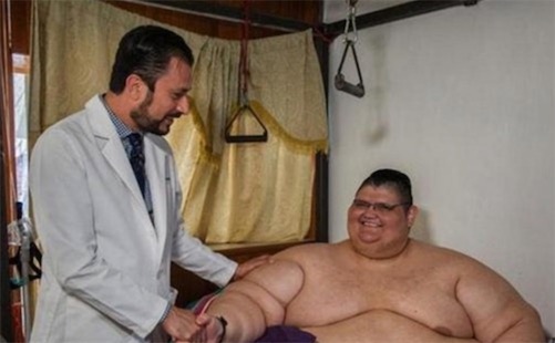 墨西哥最胖的人 Juan Pedro Franco體重曾達(dá)半噸