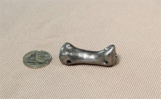 最早的骨移植手術(shù) 明代接骨名醫(yī)陳典有接骨神術(shù)