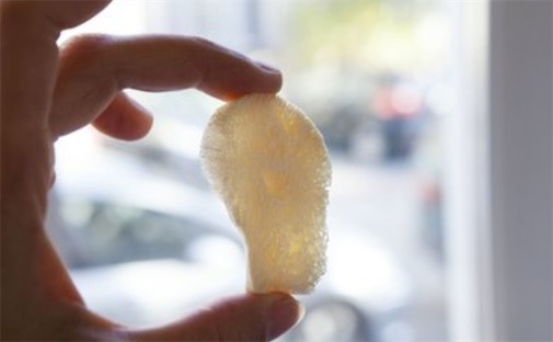 最早的骨移植手術(shù) 明代接骨名醫(yī)陳典有接骨神術(shù)