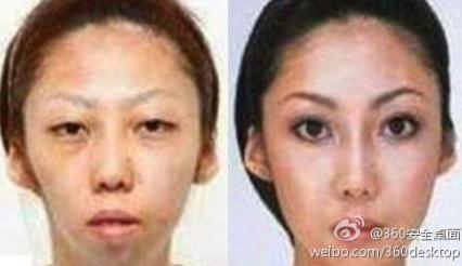 【老婆太丑】老婆漂亮女兒太丑,男子告整容老婆獲賠75萬,是整容醫(yī)院炒作嗎