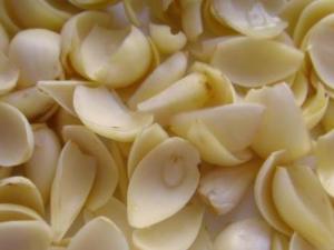 產(chǎn)婦能吃百合嗎？產(chǎn)婦吃百合的食用禁忌