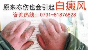 長(zhǎng)沙華山白癜風(fēng)醫(yī)院怎么樣?專于患者的健康治療