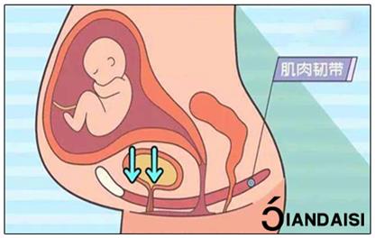 產(chǎn)后縮陰怎么做?8個建議