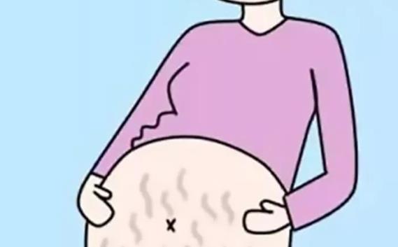 女性對于消除妊娠紋存在一定的誤解 消除妊娠紋常遇到的四大誤區(qū)