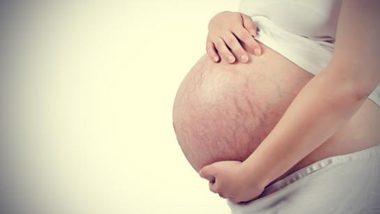 “好孕”時(shí)光——Skinception去妊娠紋霜讓你孕后無(wú)憂