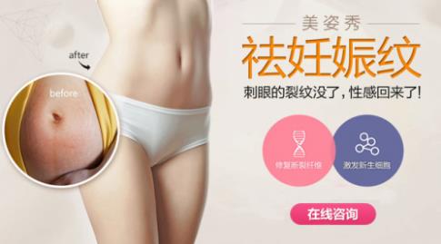 探索美姿秀現(xiàn)象,解密美姿秀被妊娠紋患者瘋轉(zhuǎn)的緣由