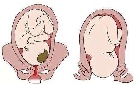生完孩子陰道松弛怎么辦,兩種方法讓你自然緊致!