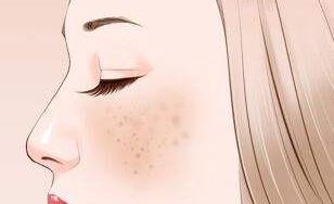 怎樣祛斑有效果?分享快速有效祛斑美白的方法